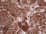 IQGAP1 Antibody in Immunohistochemistry (Paraffin) (IHC (P))