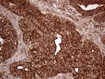 IQGAP1 Antibody in Immunohistochemistry (Paraffin) (IHC (P))