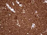 IQGAP1 Antibody in Immunohistochemistry (Paraffin) (IHC (P))