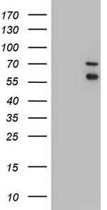 IRAK2 Antibody in Western Blot (WB)