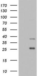 IRAK2 Antibody in Western Blot (WB)