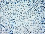 IRF3 Antibody in Immunohistochemistry (Paraffin) (IHC (P))