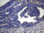 IRF3 Antibody in Immunohistochemistry (Paraffin) (IHC (P))