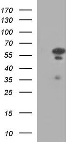 IRF5 Antibody in Western Blot (WB)