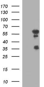 IRF5 Antibody in Western Blot (WB)