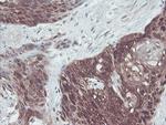 IRF6 Antibody in Immunohistochemistry (Paraffin) (IHC (P))