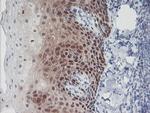 IRF6 Antibody in Immunohistochemistry (Paraffin) (IHC (P))