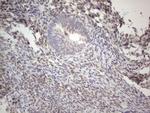 IRS1 Antibody in Immunohistochemistry (Paraffin) (IHC (P))