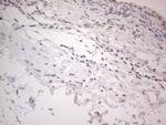 IRS1 Antibody in Immunohistochemistry (Paraffin) (IHC (P))