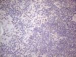 IRS1 Antibody in Immunohistochemistry (Paraffin) (IHC (P))