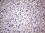 IRS1 Antibody in Immunohistochemistry (Paraffin) (IHC (P))