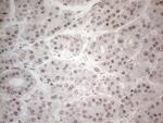 IRS1 Antibody in Immunohistochemistry (Paraffin) (IHC (P))