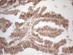 IRS1 Antibody in Immunohistochemistry (Paraffin) (IHC (P))