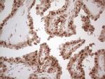 IRS1 Antibody in Immunohistochemistry (Paraffin) (IHC (P))