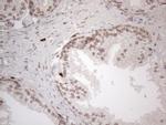 IRS1 Antibody in Immunohistochemistry (Paraffin) (IHC (P))