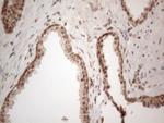 IRS1 Antibody in Immunohistochemistry (Paraffin) (IHC (P))