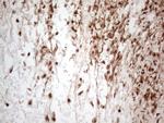 IRS1 Antibody in Immunohistochemistry (Paraffin) (IHC (P))