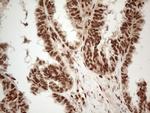 IRS1 Antibody in Immunohistochemistry (Paraffin) (IHC (P))