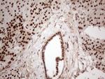 IRS1 Antibody in Immunohistochemistry (Paraffin) (IHC (P))