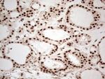 IRS1 Antibody in Immunohistochemistry (Paraffin) (IHC (P))