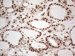 IRS1 Antibody in Immunohistochemistry (Paraffin) (IHC (P))