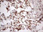 IRS1 Antibody in Immunohistochemistry (Paraffin) (IHC (P))