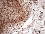 IRS1 Antibody in Immunohistochemistry (Paraffin) (IHC (P))