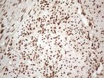 IRS1 Antibody in Immunohistochemistry (Paraffin) (IHC (P))