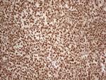 IRS1 Antibody in Immunohistochemistry (Paraffin) (IHC (P))