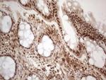 IRS1 Antibody in Immunohistochemistry (Paraffin) (IHC (P))