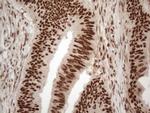 IRS1 Antibody in Immunohistochemistry (Paraffin) (IHC (P))