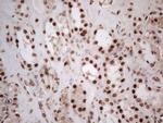 IRS1 Antibody in Immunohistochemistry (Paraffin) (IHC (P))