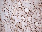 IRS1 Antibody in Immunohistochemistry (Paraffin) (IHC (P))