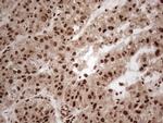 IRS1 Antibody in Immunohistochemistry (Paraffin) (IHC (P))