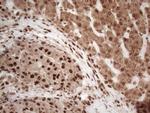 IRS1 Antibody in Immunohistochemistry (Paraffin) (IHC (P))