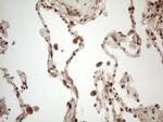 IRS1 Antibody in Immunohistochemistry (Paraffin) (IHC (P))