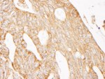 IRS2 Antibody in Immunohistochemistry (IHC)