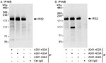 IRS2 Antibody in Immunoprecipitation (IP)