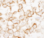 IRS2 Antibody in Immunohistochemistry (IHC)