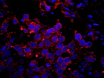 IRS2 Antibody in Immunohistochemistry (IHC)