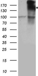 IRS2 Antibody in Western Blot (WB)