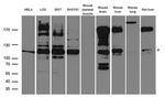 IRS2 Antibody in Western Blot (WB)