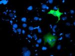 ITFG2 Antibody in Immunocytochemistry (ICC/IF)