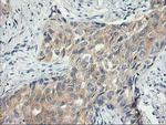 ITFG2 Antibody in Immunohistochemistry (Paraffin) (IHC (P))