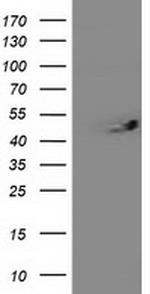 ITFG2 Antibody in Western Blot (WB)