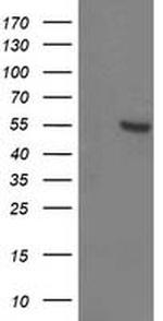 ITFG2 Antibody in Western Blot (WB)