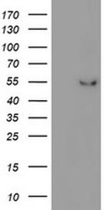 ITFG2 Antibody in Western Blot (WB)