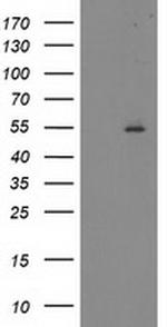 ITFG2 Antibody in Western Blot (WB)