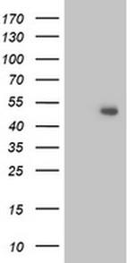 ITFG2 Antibody in Western Blot (WB)