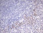 ITGB1BP1 Antibody in Immunohistochemistry (Paraffin) (IHC (P))